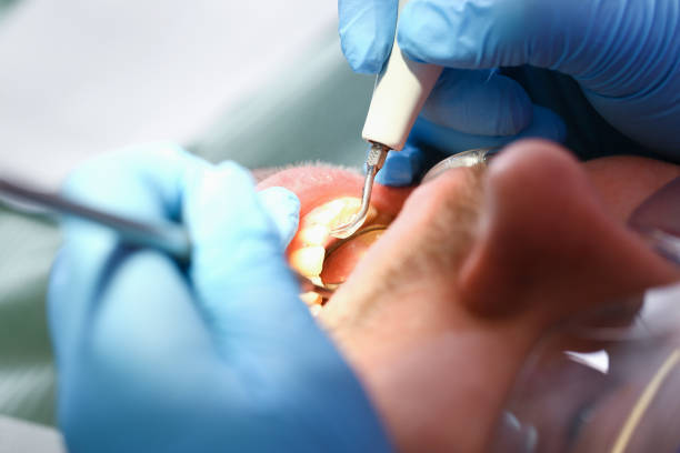 Best Emergency Dental Surgery in Lewisburg, PA